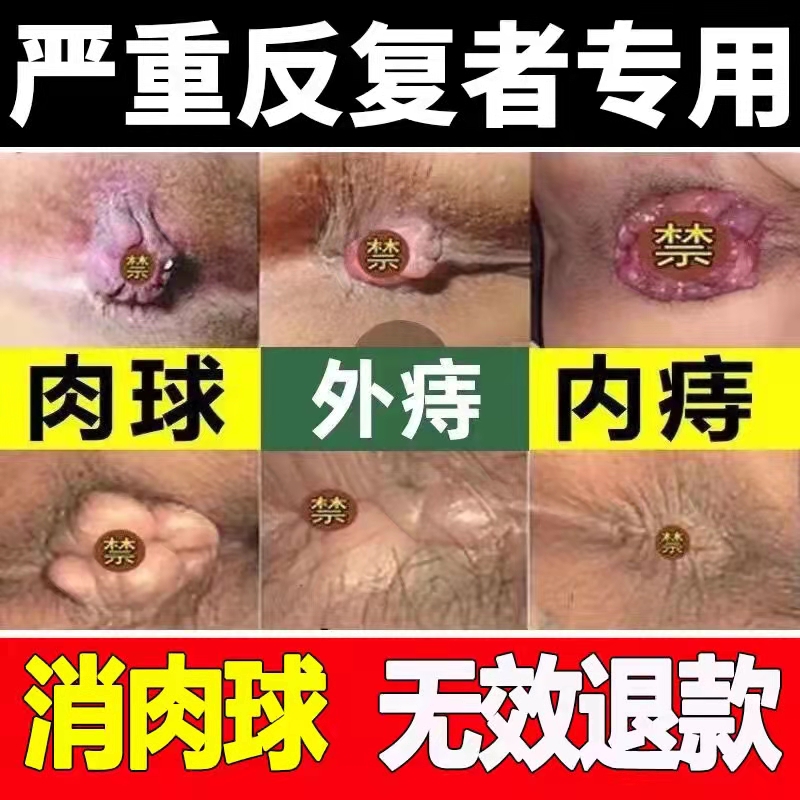 云南本草痔疮消肉球正品便血女性断痔膏内外混合型痔根断白白痔哥