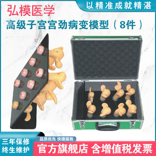 子宫宫颈病变模型弘模直观教具