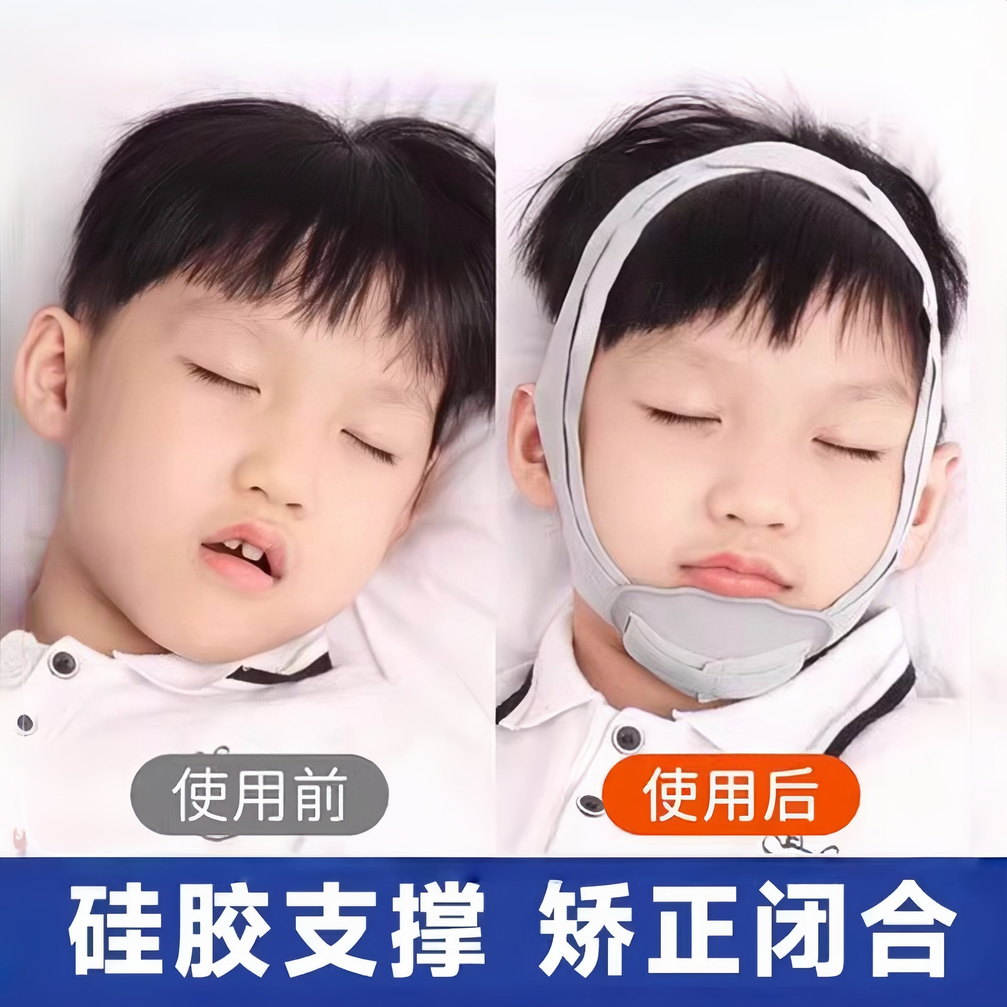 口呼吸矫正器儿童睡觉防张嘴腺样体肥大面容纠正带张口闭嘴神器贴