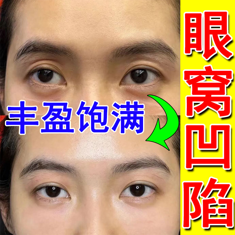 眼窝凹陷提拉紧致眼皮松弛眼肌无力睁不开眼睛下垂眼睑松弛眼膏