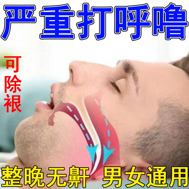 防打呼噜止鼾贴治打呼噜声神器