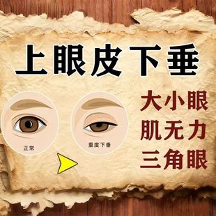 上眼皮松弛眼肌无力睁不开眼睛下垂眼睑松弛眼窝凹陷提拉紧致眼膏