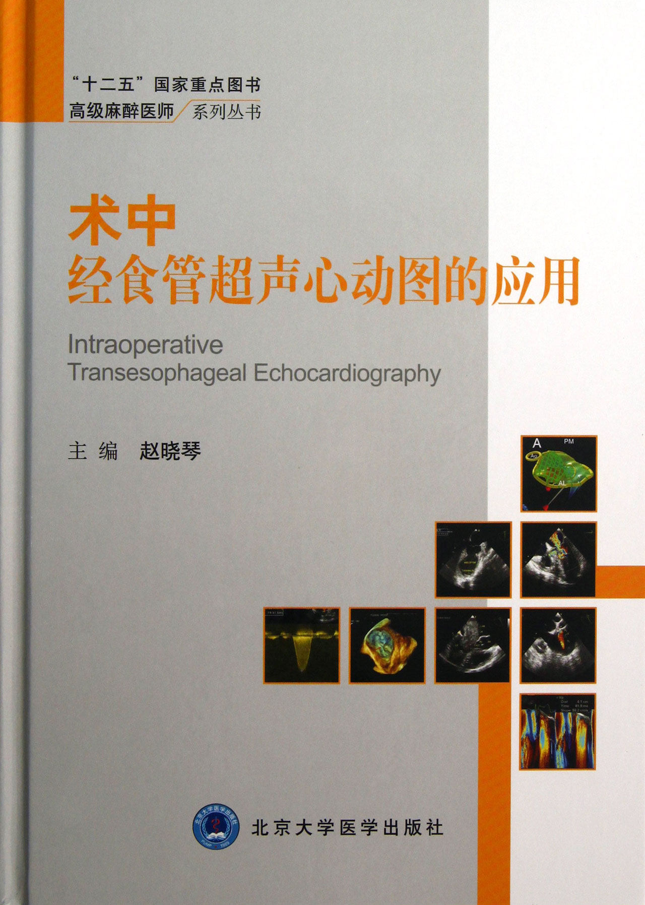 术中经食管超声心动图的应用(精)/高级麻醉医师系列丛书
