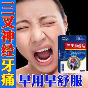 三叉神经专用贴面部顽固性重度三岔牙疼偏头痛草本热敷外用贴正品
