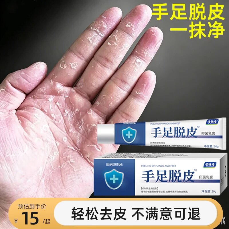 手足脱皮膏干燥起皮开裂口子手掌蜕皮掉皮手脚严重修护专用护手霜