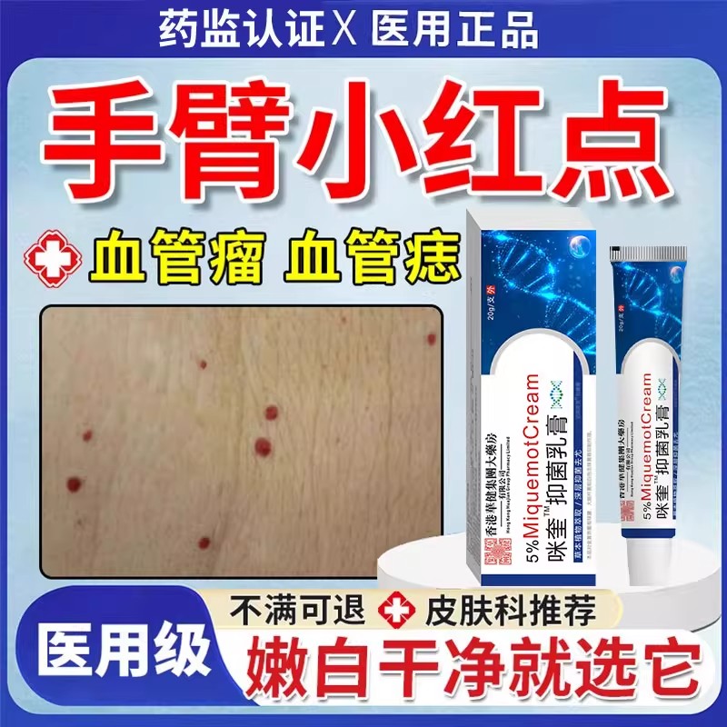 血管瘤血管痣去除可搭普萘洛尔软膏去点痣胳膊手臂上小红点红痣