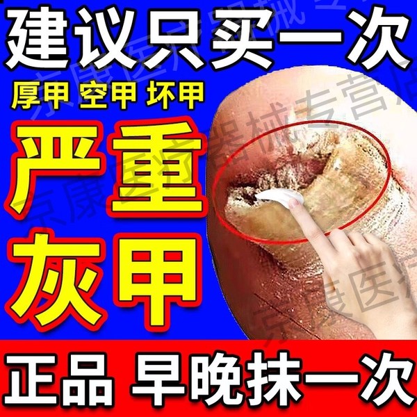 香港大药房盐酸阿莫灰指甲搽剂