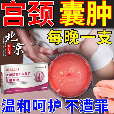 北京同仁堂宫颈纳氏囊肿药