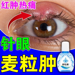 麦粒肿针眼滴眼液儿童眼睑板腺堵塞针眼红肿疼痛有硬结专用眼药水