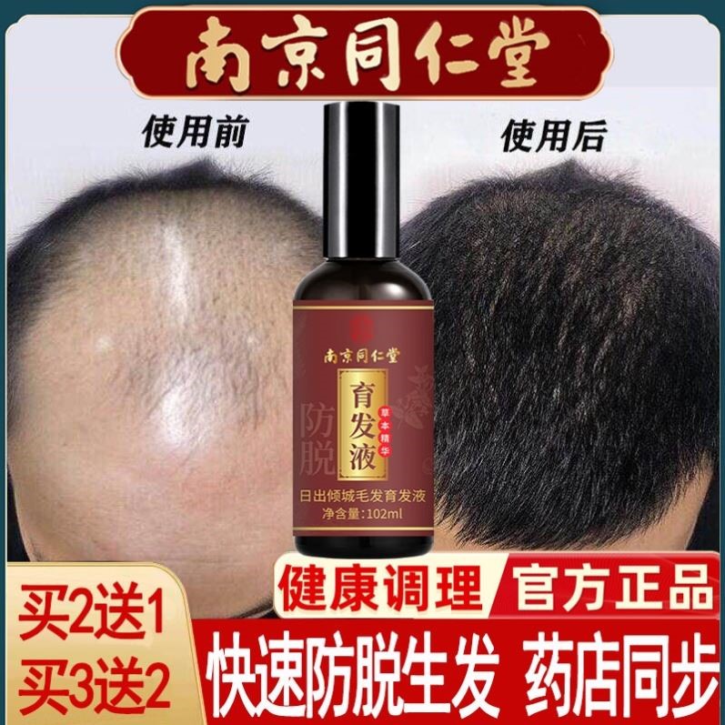 同仁堂防脱发育发液生发增发密发固发际线秃顶男女头发快速增长液
