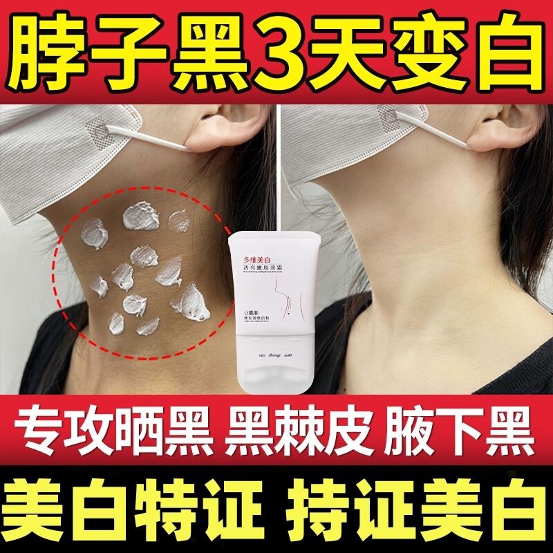 去脖子黑色素去除黑棘皮症黑色素沉淀磨砂膏腋下去黑美白颈霜神器