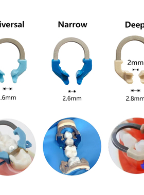 齿科镍钛夹持环 登士柏同款豆瓣成型片夹环 牙科成形片工具固位环