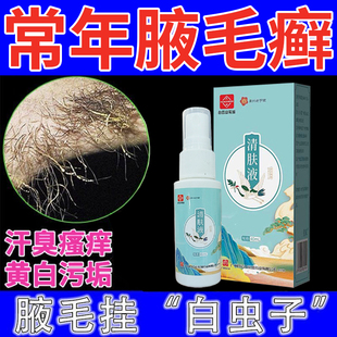 腋毛癣白色附着物清洁皮肤腋下出汗包浆污垢腋下痒除臭外用喷雾剂