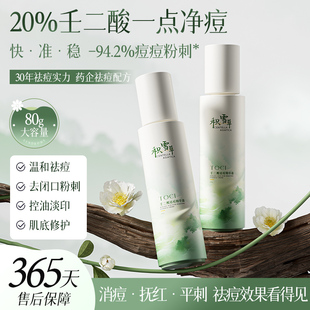【药企】TOCI 20%壬二酸祛痘膏精华霜控油瘪痘淡化痘印去闭口粉刺