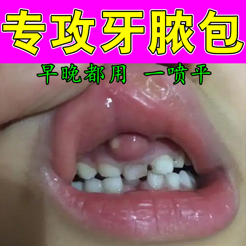牙龈肿包息肉增生口腔上火牙周息肉牙龈脓包肿痛舒缓修护喷剂