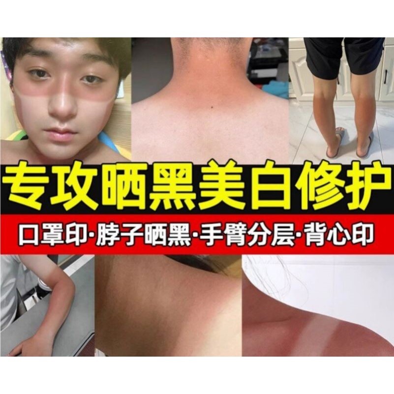 太阳紫外线晒黑了男士女士快速美白修复面部胳膊脖子皮肤变白专用