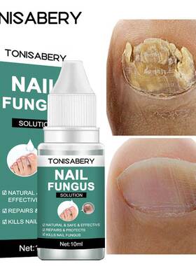 Nail Fungal Treatment Feet Care Essence Anti Infection Paro