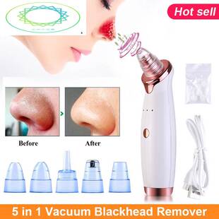 Vacuum Blackhead Remover Acne Pore Suction Face Cleaner USB