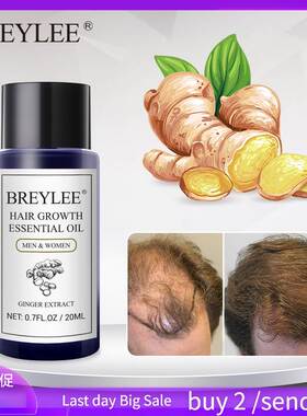 Hair Growth Essential Oil Prevent Baldness Anti-Hair Loss