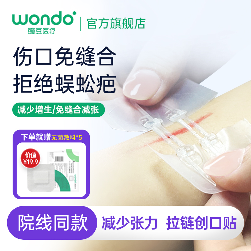 伤口减张防止疤痕变宽医用拉扣式