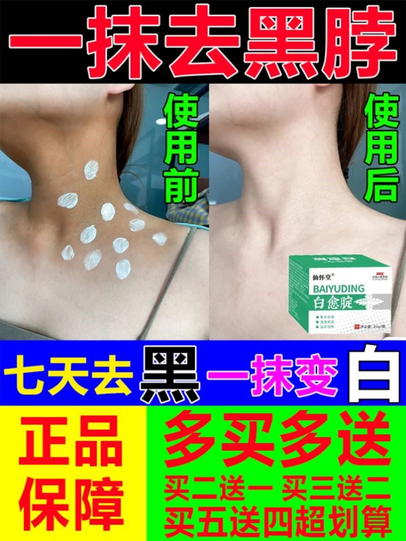 儿童脖子后面洗不干净脖子黑黑的黑棘皮症去除黑色素沉淀美白愈腚