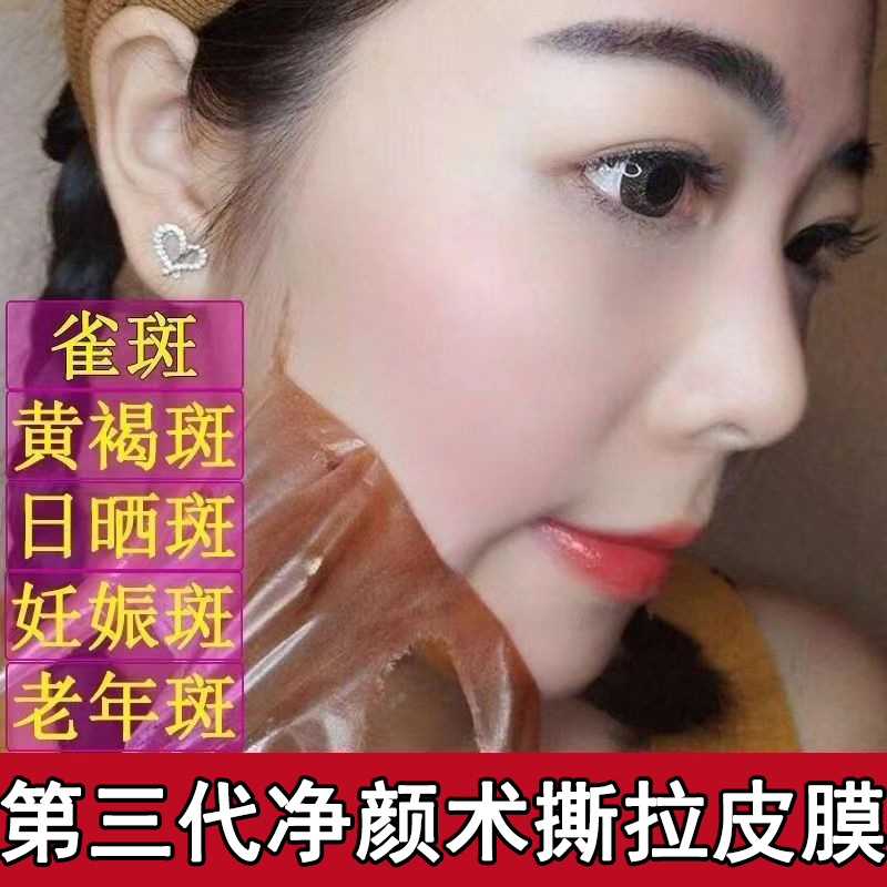 吸斑撕拉面膜美容院黑科技美白祛斑神器雀斑淡化色斑淡斑晒斑色斑