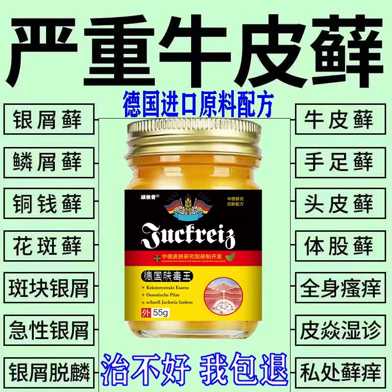 德国肤毒王治疗牛皮屑病外用药头皮手足体真菌感染牛皮藓银专用膏