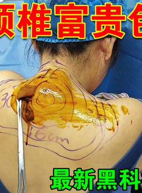 【冶好100W+人】富贵包颈椎贴头晕引起压迫神经热敷疏通专用贴膏