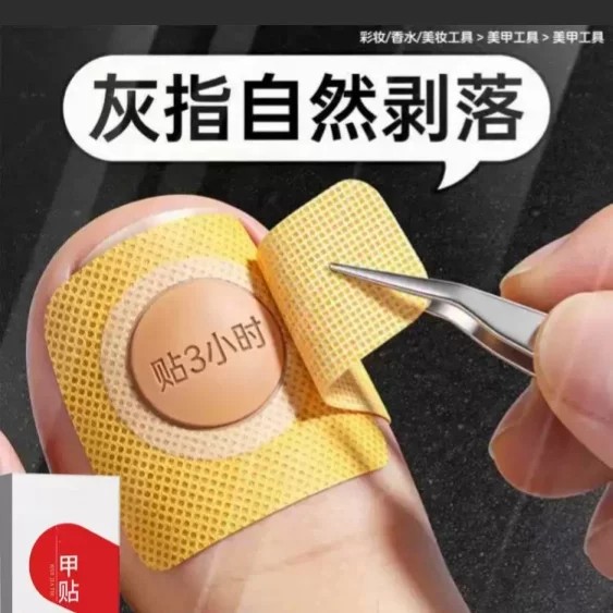【官方正品】指甲贴正品专用灰趾贴植物萃取脚趾手指甲修护专用贴