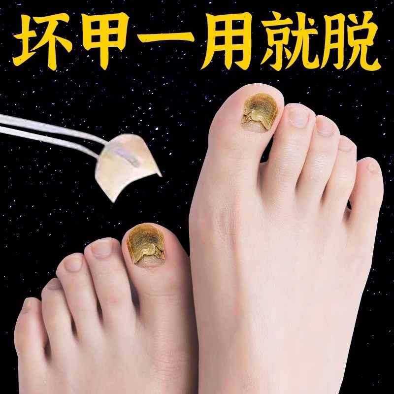 日本汉方制药灰甲护理液滴一滴