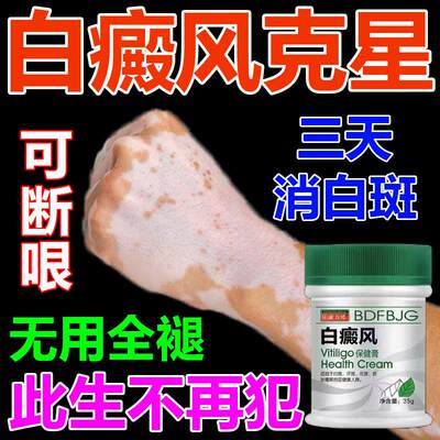 白癜风克星膏白癜风外用黑色素生长快速消白斑专用治疗白癜风外用