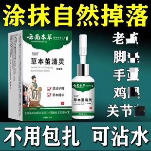 云南本草去老茧关节茧手脚底老茧专用脚垫脚趾去除厚茧软化液