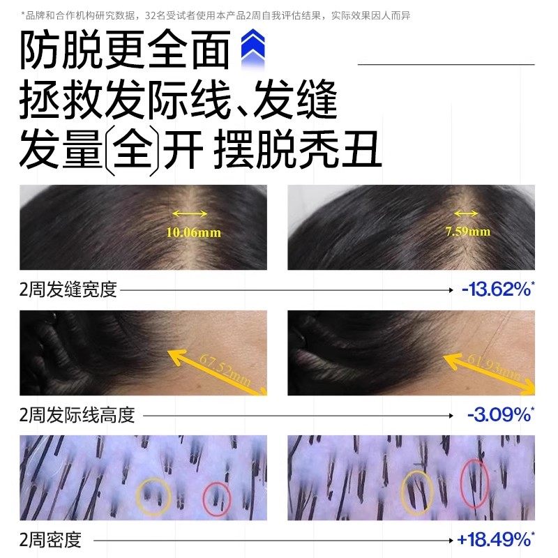 【蜜蜂心愿社】EHD防脱防断洗发水囤货套装-DB