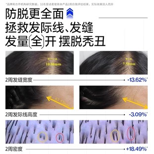 EHD防脱洗发水750ml 蜜蜂心愿社