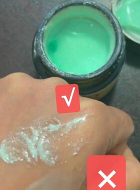 老中医祛痘膏小金瓶祛痘淡化痘印顽固型痘痘控油酒精味