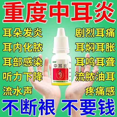 中耳炎特效药膏专用药可除根耳朵痒止痒抑菌流脓流水发炎的滴耳液