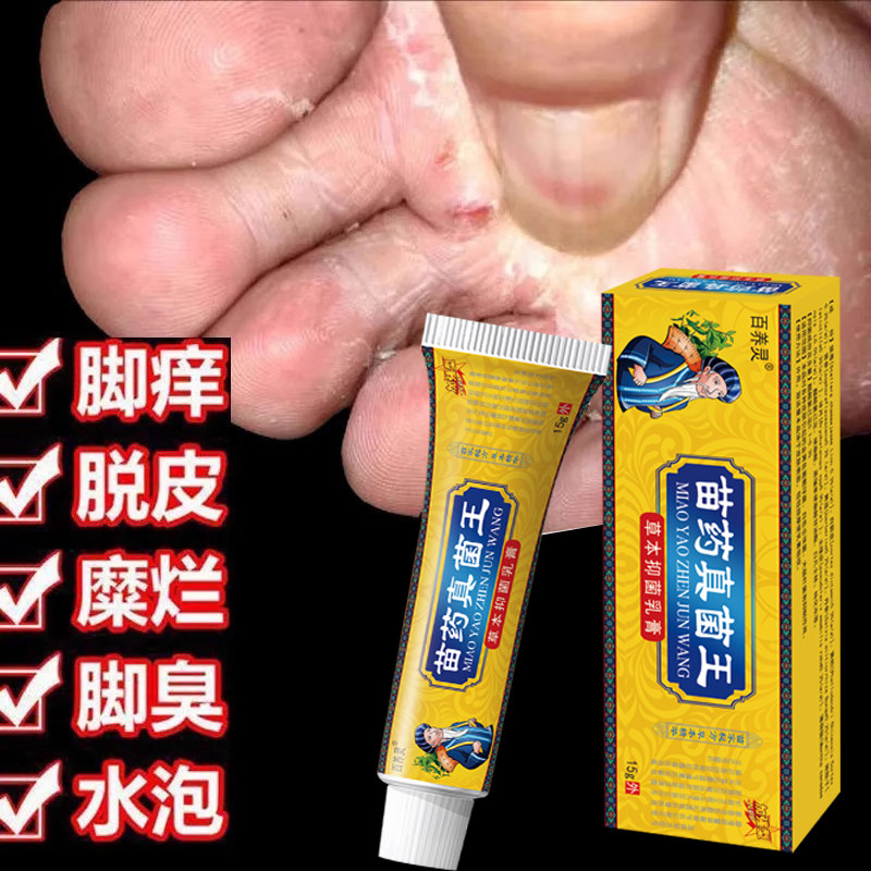 云南本草苗药真菌王脚气脚臭脚痒水泡脱皮香港脚汗感染止痒膏抑菌