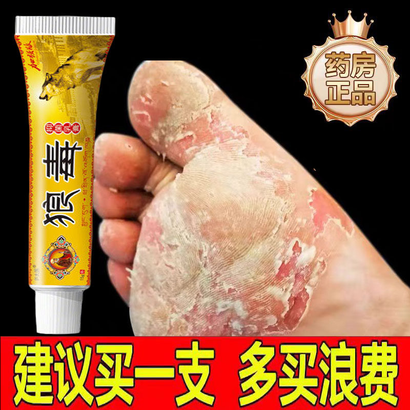 狼毒脚王脚气药脚气止痒脱皮杀菌特效膏烂脚丫药脱皮糜烂脚趾真菌