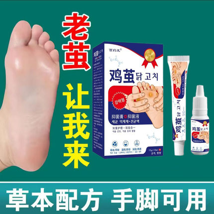 百约王鸡眼膏去除老茧死皮老茧足部脚掌脚垫硬皮无痛去鸡眼贴特效