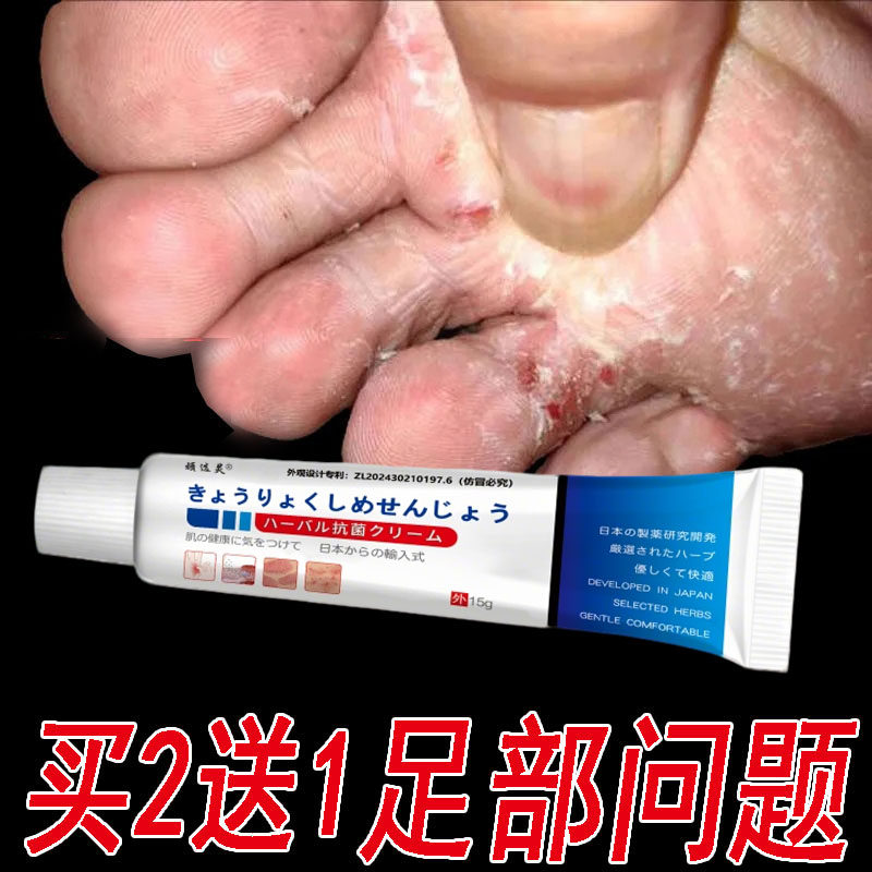 日本进口脚气止痒脱皮杀菌专用脚痒去痒根真菌感染水泡脱皮烂脚药