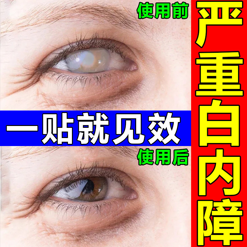 红霉素眼药水熊胆滴眼液急性细菌性结膜炎沙眼角膜炎红眼病