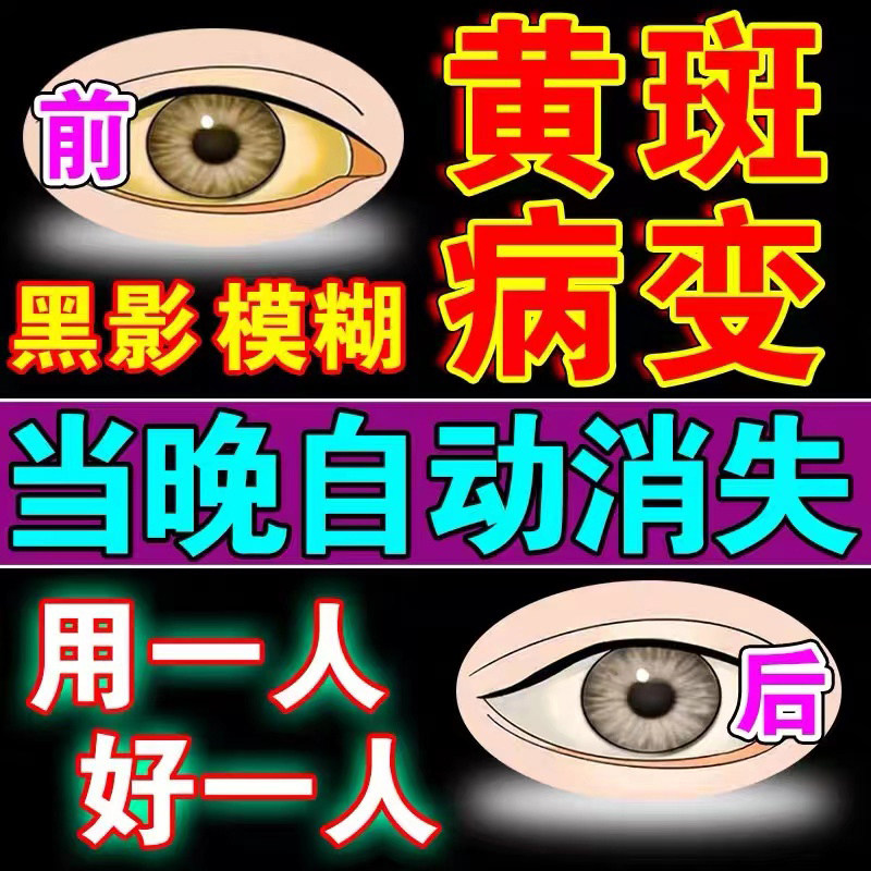 拨云锭老拨云堂眼药水明目退翳火眼视网膜目赤肿痛翼状胬肉滴眼液