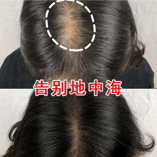 米诺地尔酊美商 明天好发迹厦门美商5%浓度