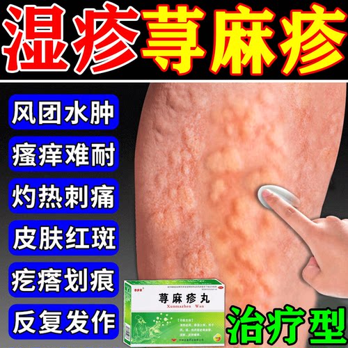 【泰多安】荨麻疹丸10g*5袋/盒