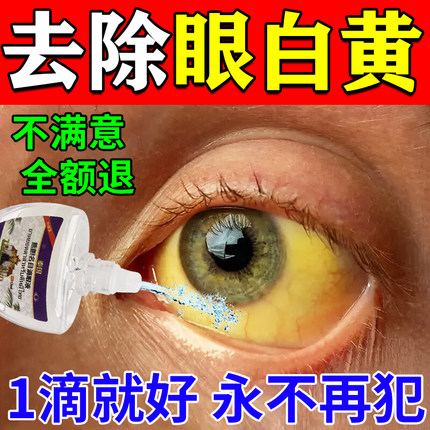 眼白发黄眼睛清澈去黄红血丝滴眼液修复眼底有黄斑浑浊病变眼药水