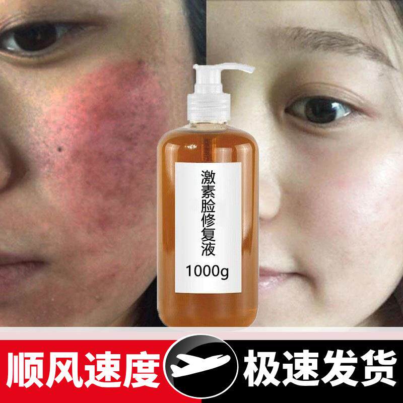 激素脸修复液去红血丝退红增强角质层敏感肌积雪草原液修复精华液