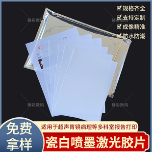 B超打印纸胃镜胶片四维胶片彩超胶片瓷白喷墨胶片激光胶片唛头纸