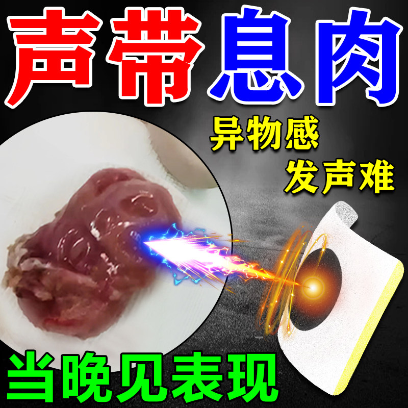 声带息肉药贴喉咙肿痛异物感