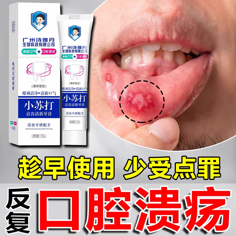 口腔溃疡专用牙膏成人儿童上火舌头溃疡牙龈出血肿疼痛含漱液凝胶 - 实物图