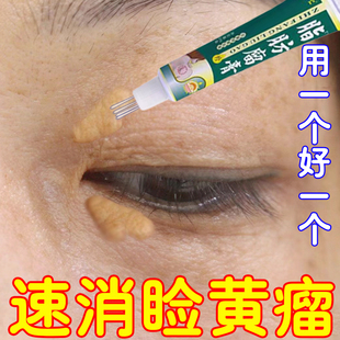 眼睑黄瘤膏去除睑黄瘤药膏去眼睑黄斑眼角黄瘤黄色肉块小颗粒专用